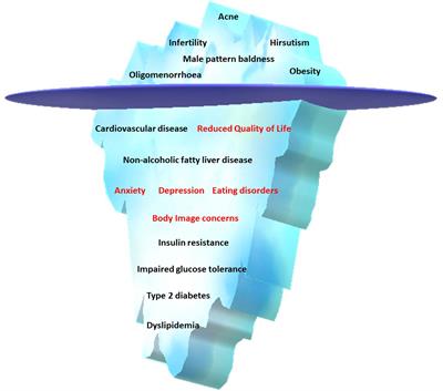 A systematic review of models of care for polycystic ovary syndrome highlights the gap in the literature, especially in developing countries